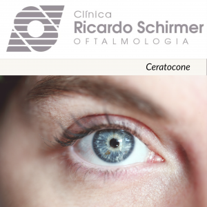 Read more about the article Ceratocone