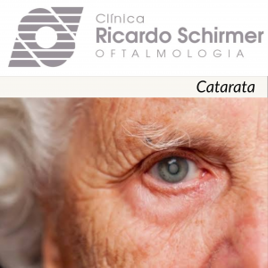 Read more about the article Catarata